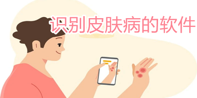 通過拍照掃一掃，輕松識別皮膚病——你的皮膚健康助手，拍照掃一掃，即刻識別皮膚病，皮膚健康智能助手