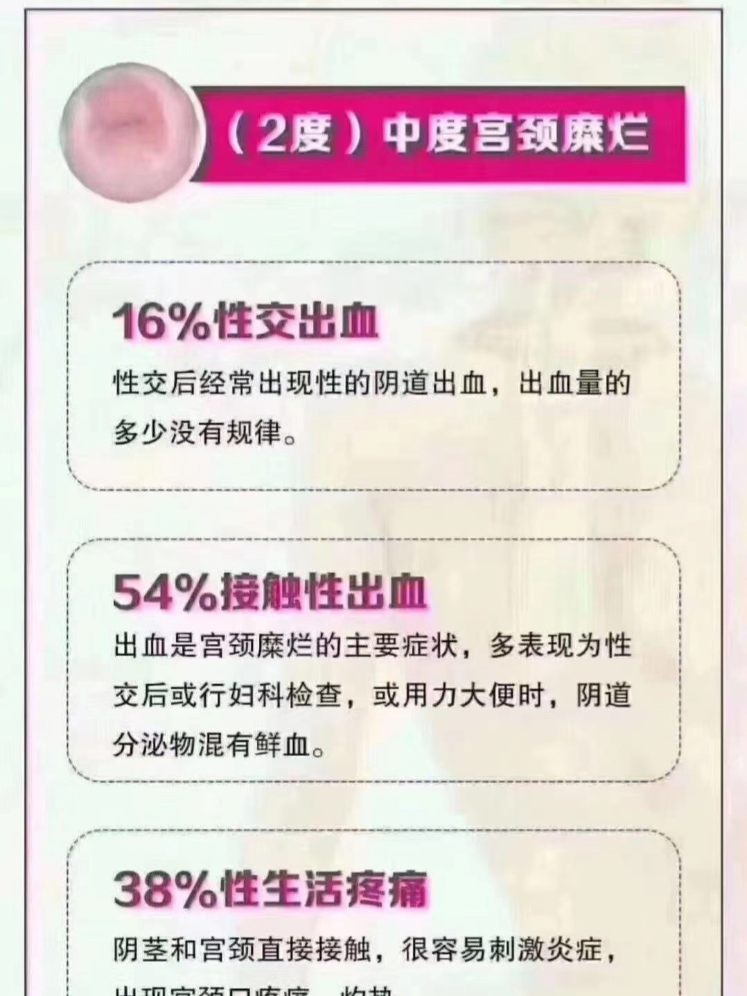 宮頸糜爛幾度會引發(fā)流血及其相關解析，宮頸糜爛引發(fā)流血的幾度及相關解析探討